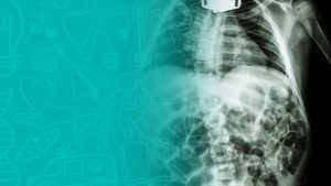 The GOSH Paediatric Long-Term Ventilation Course - May 2025